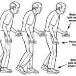 Parkinson's Disease Treatment