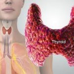 Thyroid Disorders Treatment