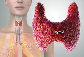 Thyroid Disorders Treatment